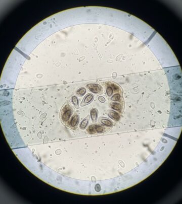 Complete guide to coccidia in rabbits: Learn symptoms, diagnosis methods, and effective treatment options.